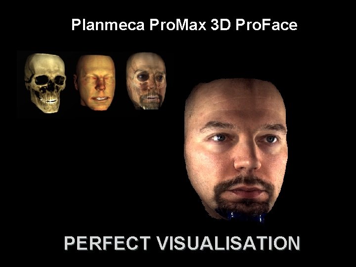 Planmeca Pro. Max 3 D Pro. Face PERFECT VISUALISATION 