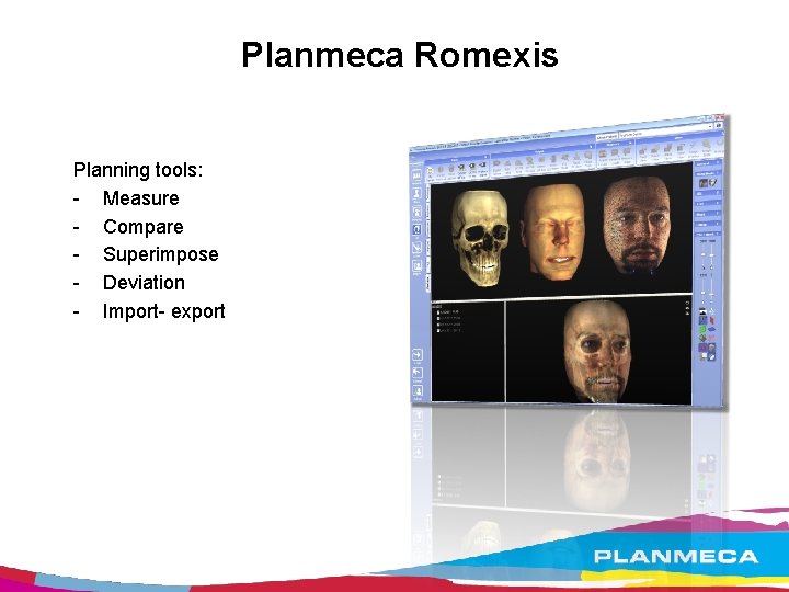 Planmeca Romexis Planning tools: - Measure - Compare - Superimpose - Deviation - Import-