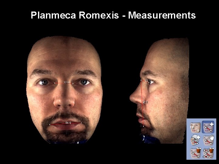 Planmeca Romexis - Measurements 