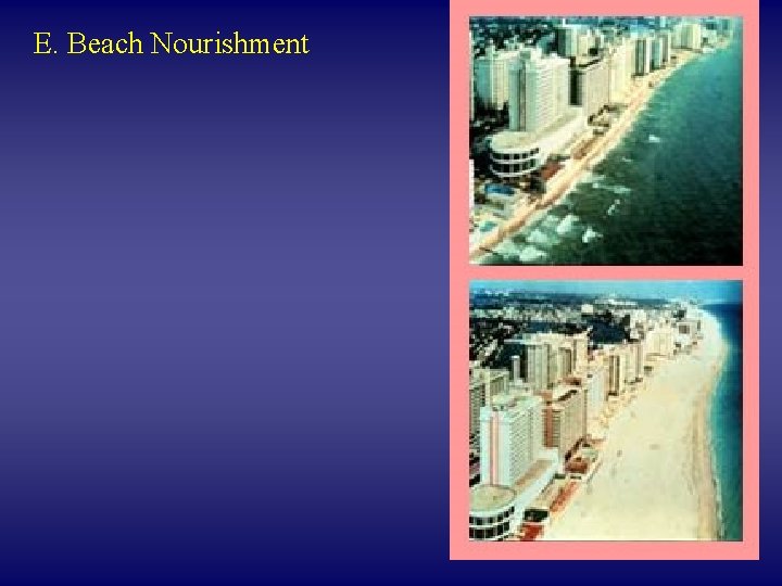 E. Beach Nourishment 