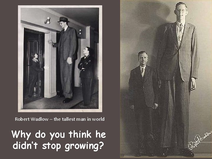 Robert Wadlow – the tallest man in world Why do you think he didn’t