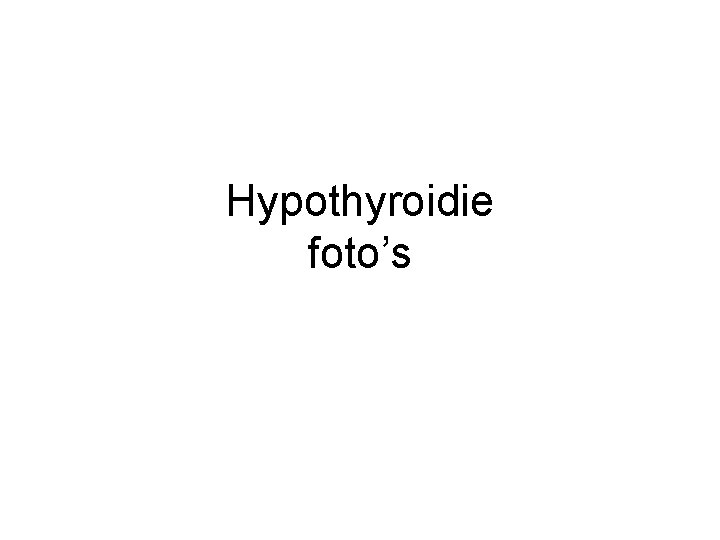 Hypothyroidie foto’s 