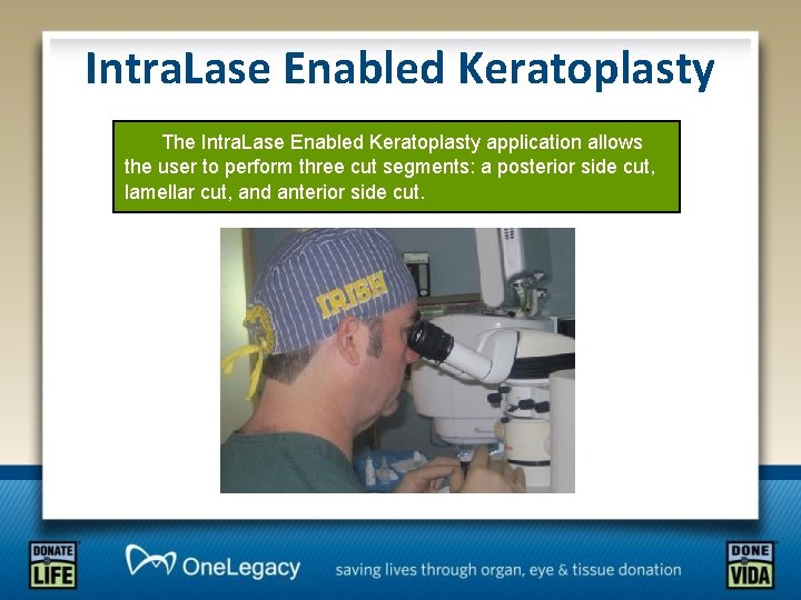Intra. Lase Enabled Keratoplasty The Intra. Lase Enabled Keratoplasty application allows the user to