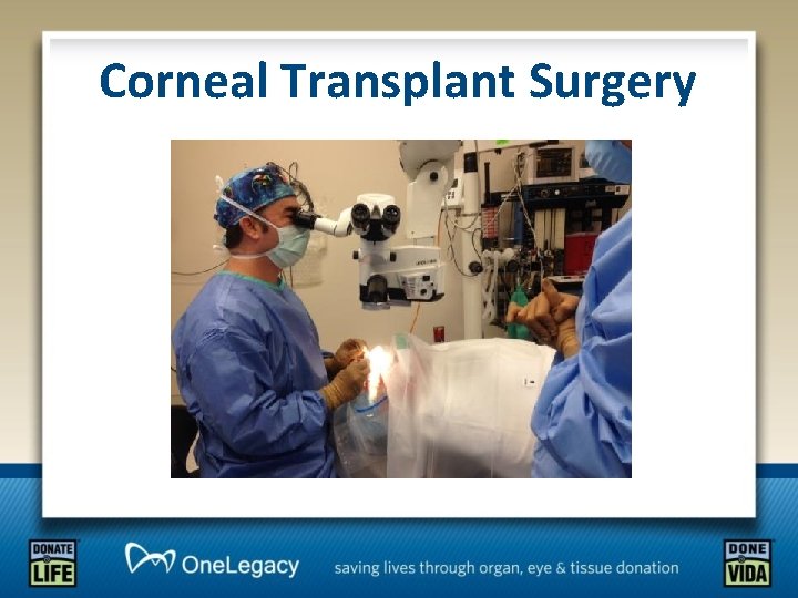 Corneal Transplant Surgery 