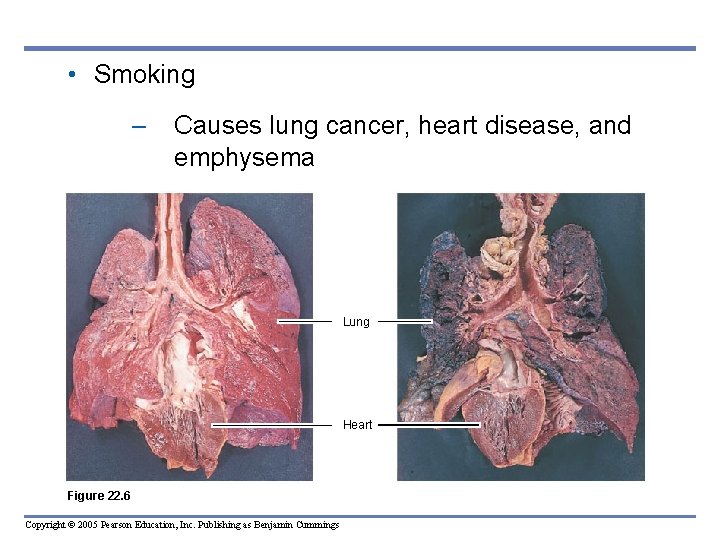  • Smoking – Causes lung cancer, heart disease, and emphysema Lung Heart Figure