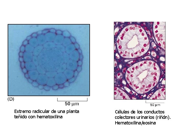 Extremo radicular de una planta teñido con hematoxilina Células de los conductos colectores urinarios Extremo radicular de una planta teñido con hematoxilina Células de los conductos colectores urinarios