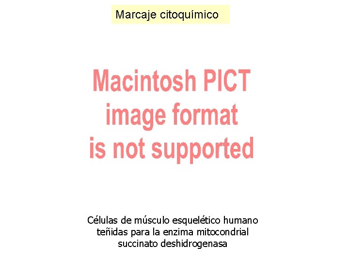 Marcaje citoquímico Células de músculo esquelético humano teñidas para la enzima mitocondrial succinato deshidrogenasa Marcaje citoquímico Células de músculo esquelético humano teñidas para la enzima mitocondrial succinato deshidrogenasa