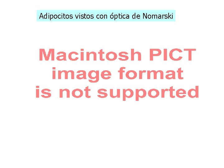 Adipocitos vistos con óptica de Nomarski Adipocitos vistos con óptica de Nomarski