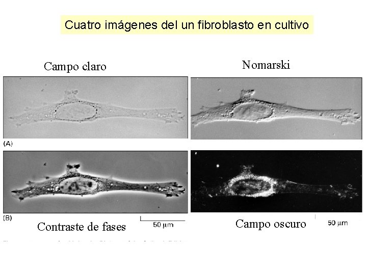 Cuatro imágenes del un fibroblasto en cultivo Campo claro Contraste de fases Nomarski Campo Cuatro imágenes del un fibroblasto en cultivo Campo claro Contraste de fases Nomarski Campo