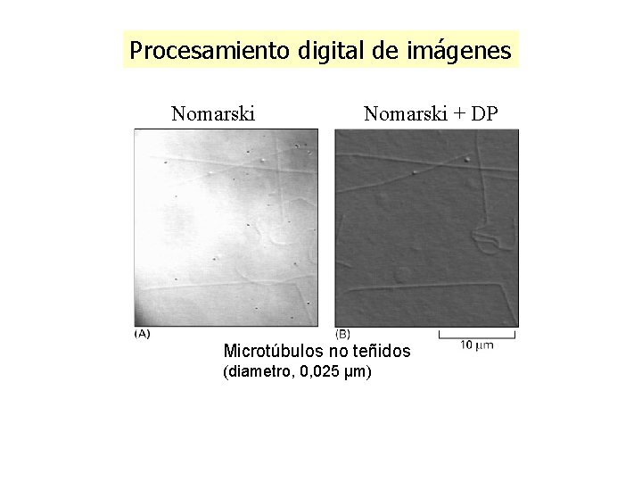 Procesamiento digital de imágenes Nomarski + DP Microtúbulos no teñidos (diametro, 0, 025 µm) Procesamiento digital de imágenes Nomarski + DP Microtúbulos no teñidos (diametro, 0, 025 µm)