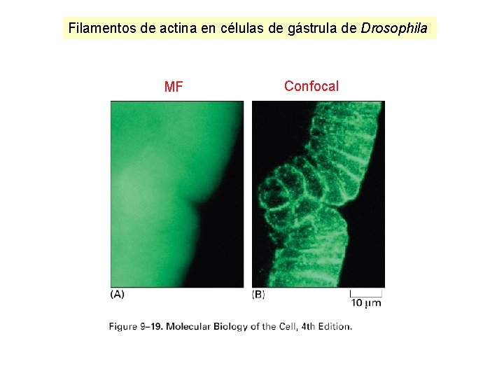 Filamentos de actina en células de gástrula de Drosophila MF Confocal Filamentos de actina en células de gástrula de Drosophila MF Confocal