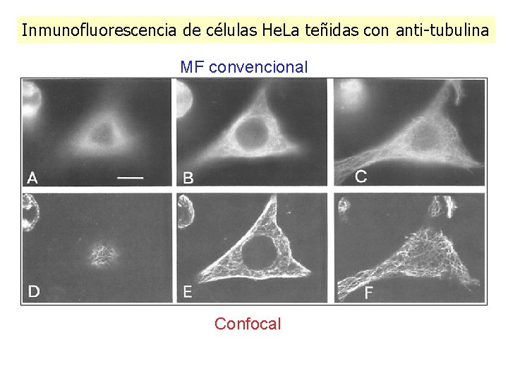 Inmunofluorescencia de células He. La teñidas con anti-tubulina MF convencional Confocal Inmunofluorescencia de células He. La teñidas con anti-tubulina MF convencional Confocal