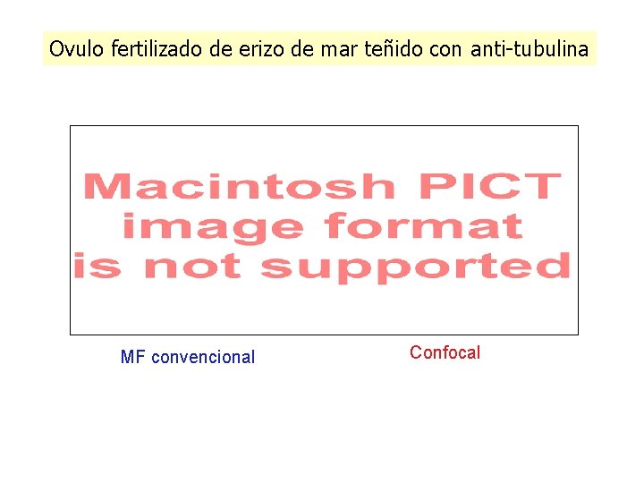 Ovulo fertilizado de erizo de mar teñido con anti-tubulina MF convencional Confocal Ovulo fertilizado de erizo de mar teñido con anti-tubulina MF convencional Confocal