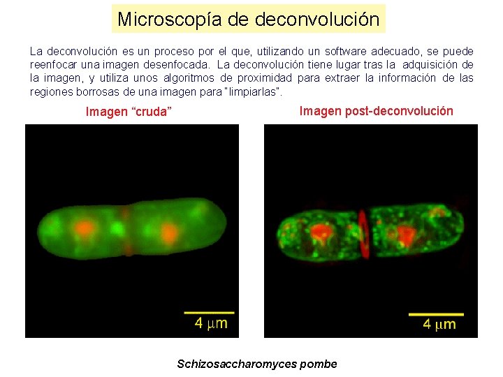 Microscopía de deconvolución La deconvolución es un proceso por el que, utilizando un software Microscopía de deconvolución La deconvolución es un proceso por el que, utilizando un software