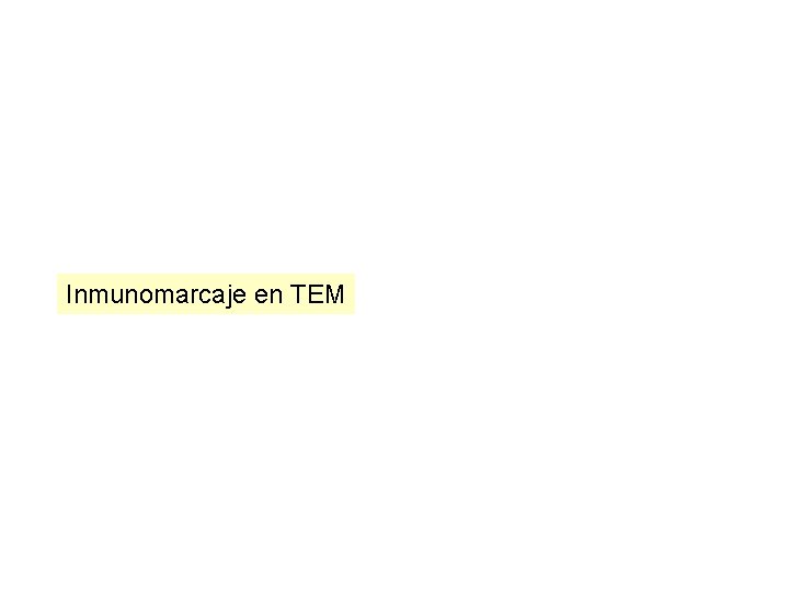 Inmunomarcaje en TEM Inmunomarcaje en TEM