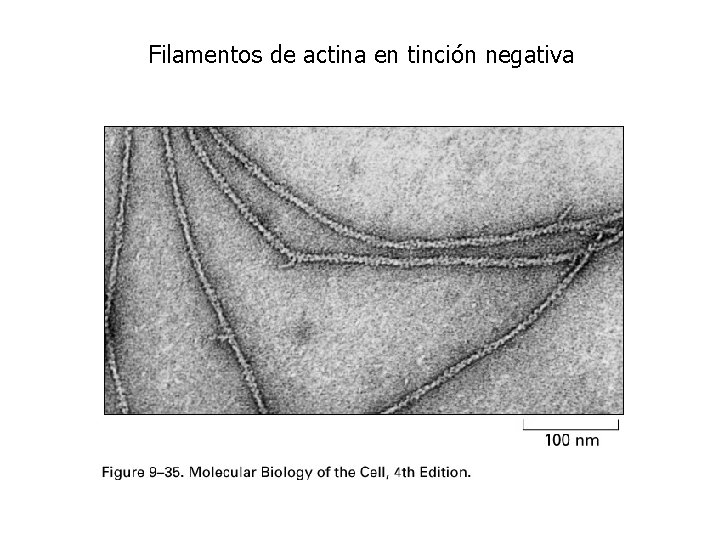Filamentos de actina en tinción negativa Filamentos de actina en tinción negativa