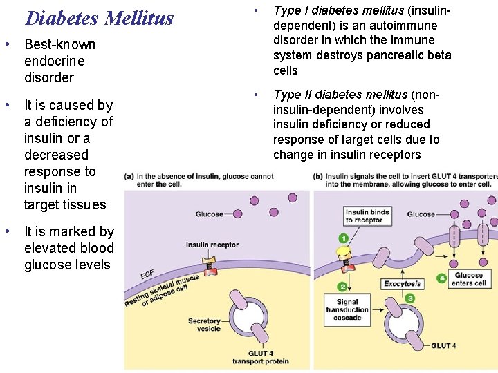 Diabetes Mellitus • Type I diabetes mellitus (insulindependent) is an autoimmune disorder in which