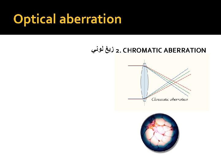 Optical aberration ﺯﻳﻎ ﻟﻮﻧﻲ 2. CHROMATIC ABERRATION 