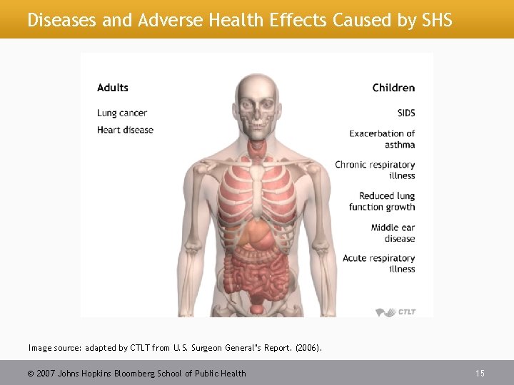 Diseases and Adverse Health Effects Caused by SHS Image source: adapted by CTLT from