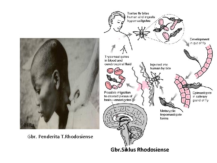 Gbr. Penderita T. Rhodosiense Gbr. Siklus Rhodosiense 