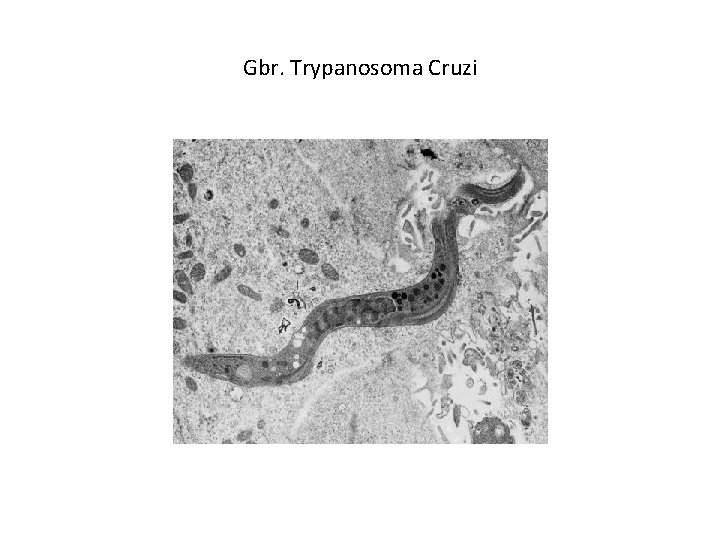 Gbr. Trypanosoma Cruzi 