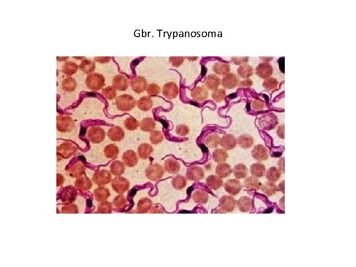 Gbr. Trypanosoma 