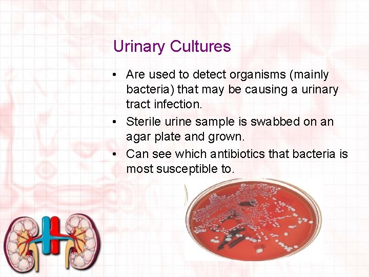 Urinary Cultures • Are used to detect organisms (mainly bacteria) that may be causing