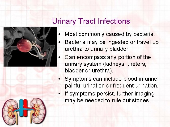 Urinary Tract Infections • Most commonly caused by bacteria. • Bacteria may be ingested