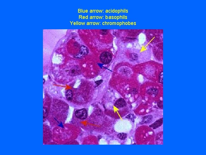Blue arrow: acidophils Red arrow: basophils Yellow arrow: chromophobes 