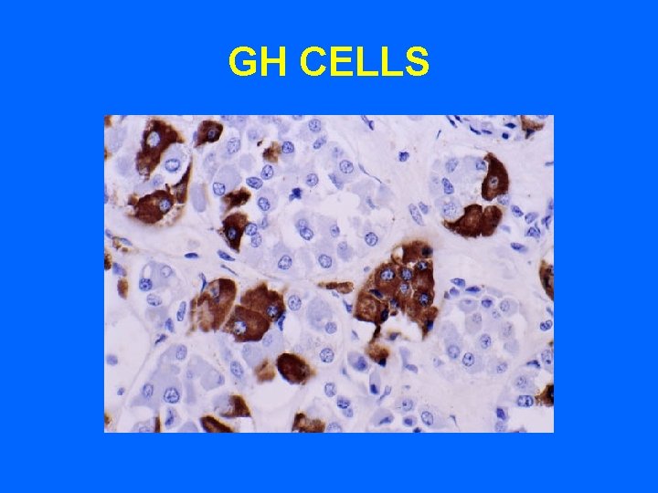 GH CELLS 