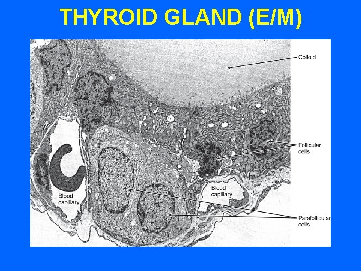 THYROID GLAND (E/M) 