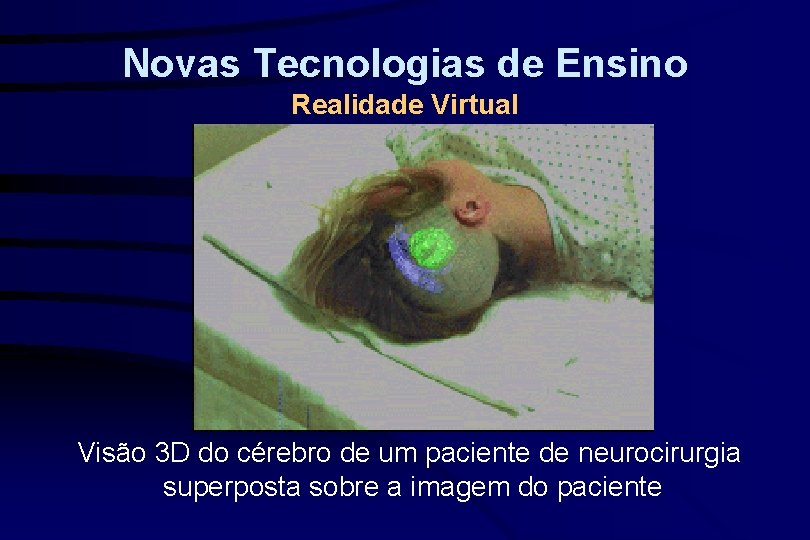 Novas Tecnologias de Ensino Realidade Virtual Visão 3 D do cérebro de um paciente