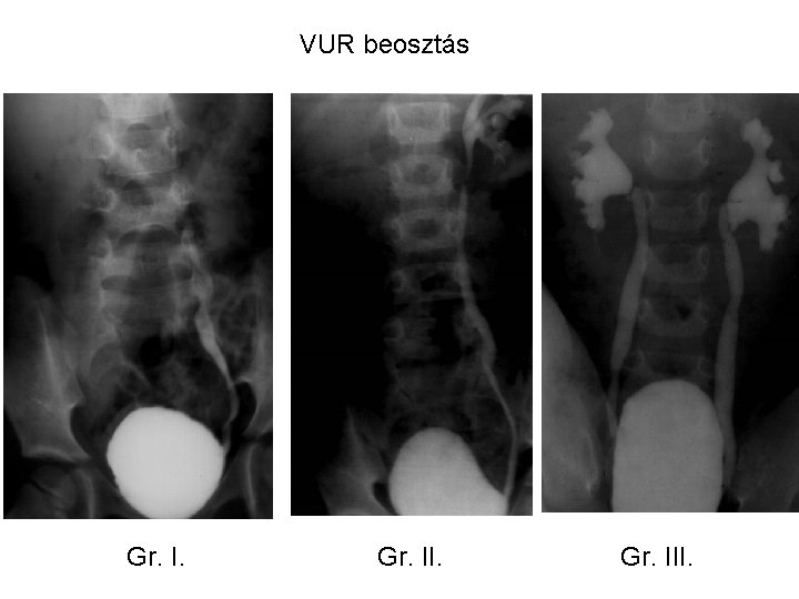 VUR beosztás Gr. III. 