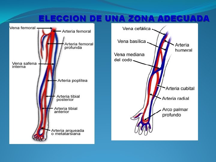 ELECCION DE UNA ZONA ADECUADA 