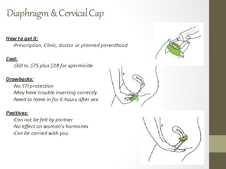 Diaphragm & Cervical Cap How to get it: -Prescription, Clinic, doctor or planned parenthood