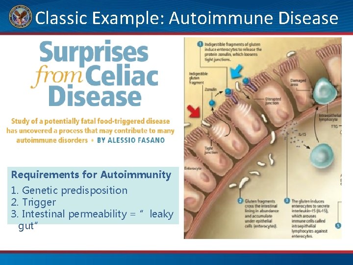 Classic Example: Autoimmune Disease Requirements for Autoimmunity 1. Genetic predisposition 2. Trigger 3. Intestinal