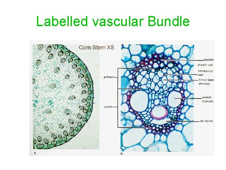 Labelled vascular Bundle 