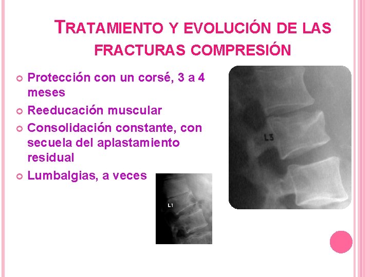 TRATAMIENTO Y EVOLUCIÓN DE LAS FRACTURAS COMPRESIÓN Protección con un corsé, 3 a 4