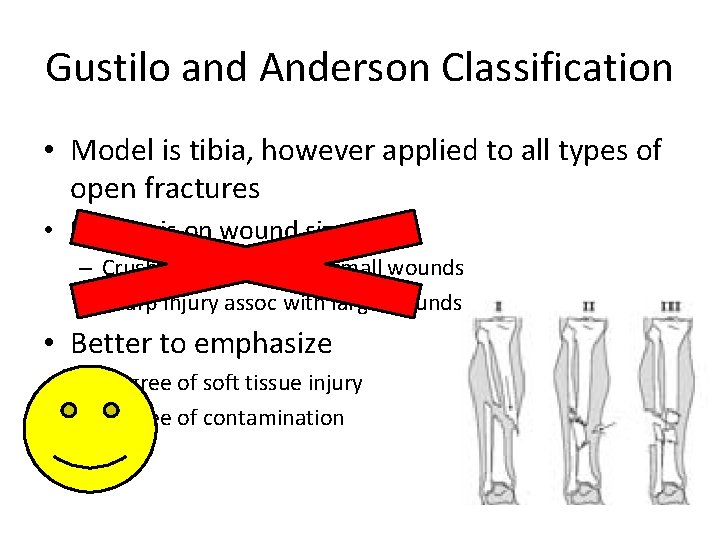 Gustilo and Anderson Classification • Model is tibia, however applied to all types of