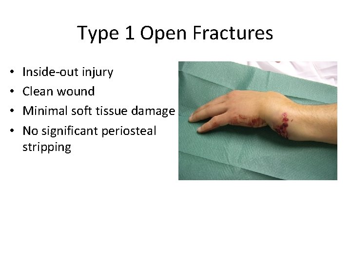 Type 1 Open Fractures • • Inside-out injury Clean wound Minimal soft tissue damage