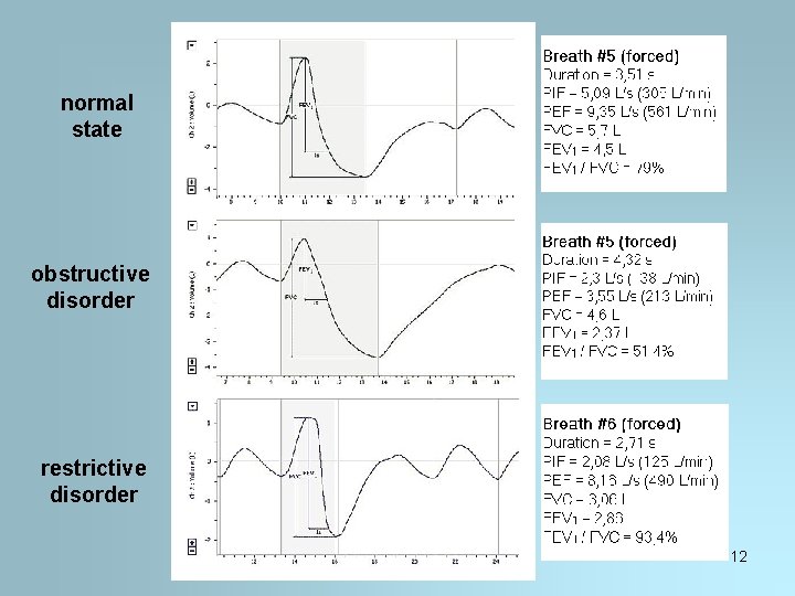 normal state obstructive disorder restrictive disorder 12 