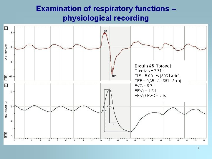 Examination of respiratory functions – physiological recording 7 