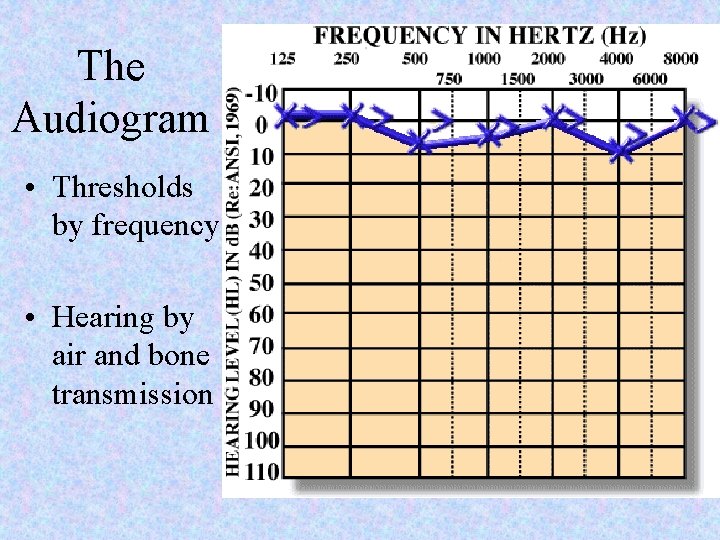 The Audiogram • Thresholds by frequency • Hearing by air and bone transmission 