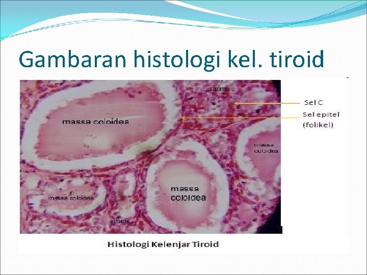 Gambaran histologi kel. tiroid 