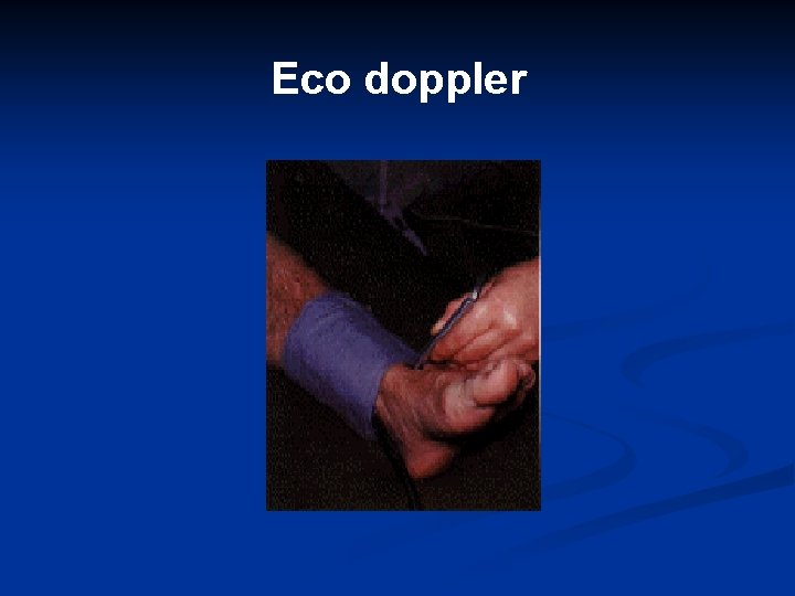 Eco doppler 
