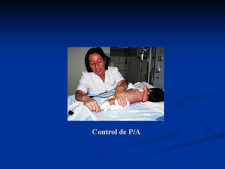 Control de P/A 