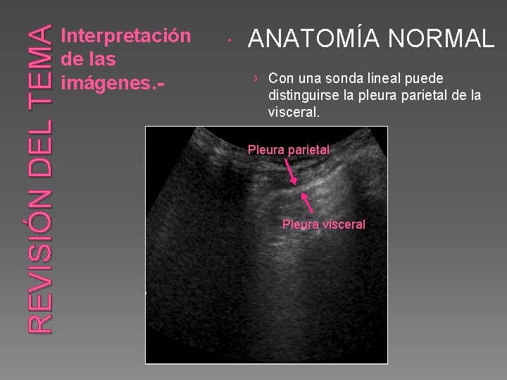 REVISIÓN DEL TEMA Interpretación de las imágenes. - ANATOMÍA NORMAL › Con una sonda