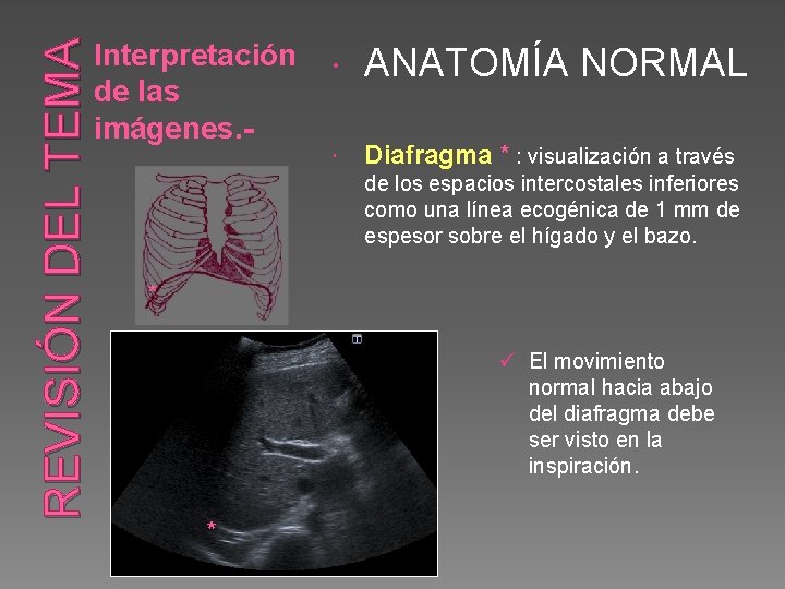 REVISIÓN DEL TEMA Interpretación de las imágenes. - ANATOMÍA NORMAL Diafragma * : visualización