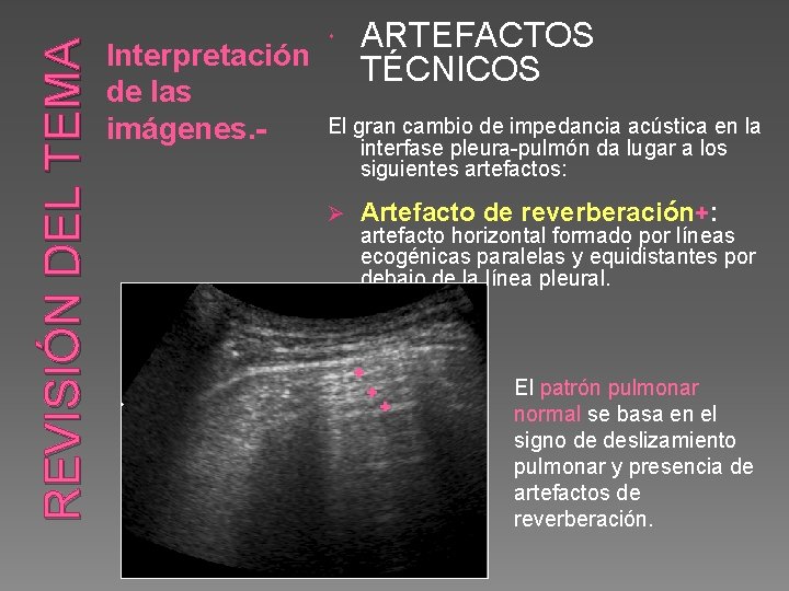 REVISIÓN DEL TEMA Interpretación de las imágenes. - ARTEFACTOS TÉCNICOS El gran cambio de