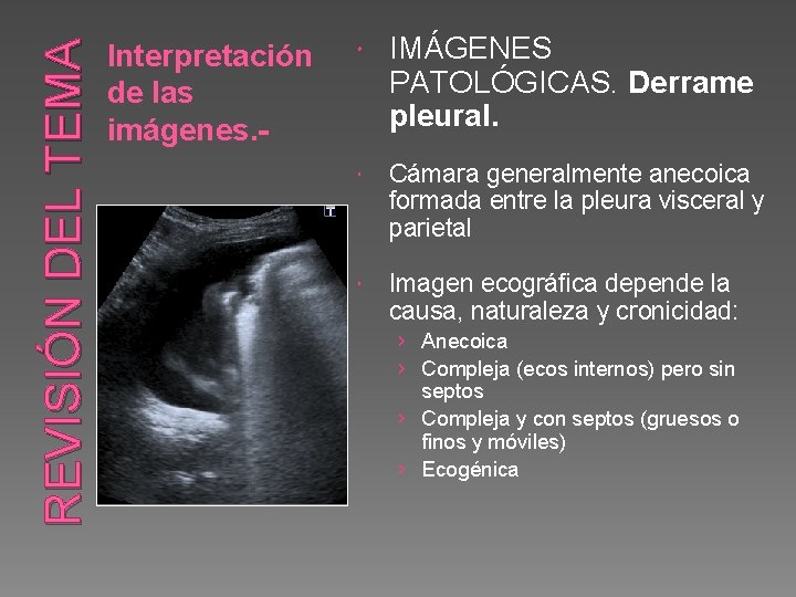 REVISIÓN DEL TEMA Interpretación de las imágenes. - IMÁGENES PATOLÓGICAS. Derrame pleural. Cámara generalmente